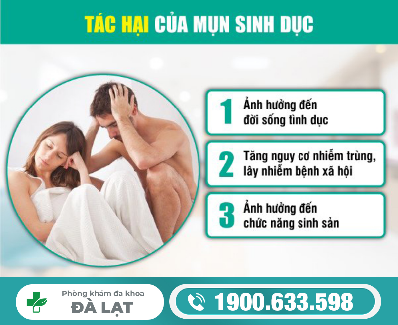 Hình ảnh minh họa